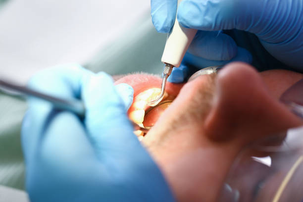 Best Tooth Infection Emergency Dentist  in Goldthwaite, TX